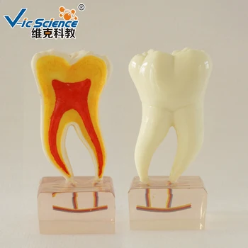 6-кратная анатомическая модель зубов /Модель зубов / Модель зубов