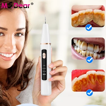 Ms.Dear Электрический очиститель зубного камня Зубная высокочастотная вибрация для удаления зубного камня, пятен от зубного налета, Отбеливающая зубная щетка