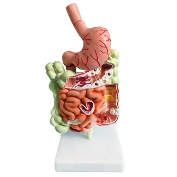 Модель пищеварительной системы человека Анатомия желудка Толстая кишка Слепая кишка Прямая кишка Двенадцатиперстная кишка Модель структуры внутренних органов человека