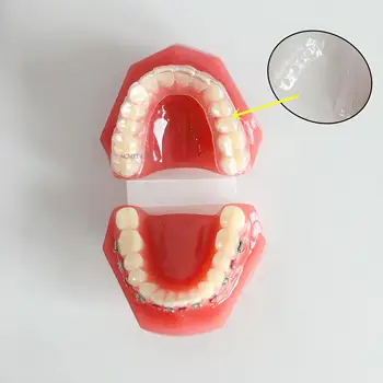 Обучающая модель зуба для стоматологии Высококачественные ортодонтические модели зубов Невидимый прозрачный кронштейн для стоматологии